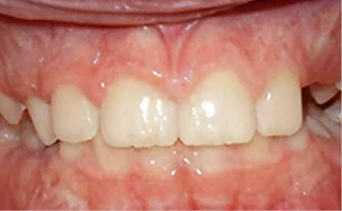 After Image 1