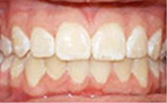 After Image 3