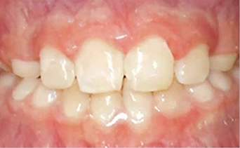 After Image 2