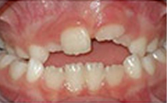 Before Image 4