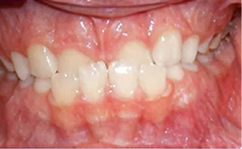 Before Image 1
