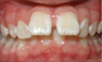 Before Image 3