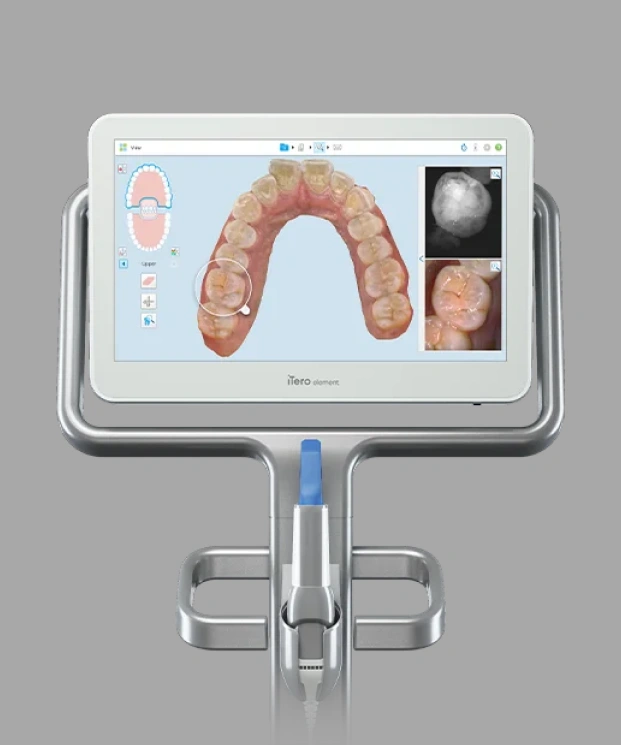 iTero<sup>®</sup> Scanner