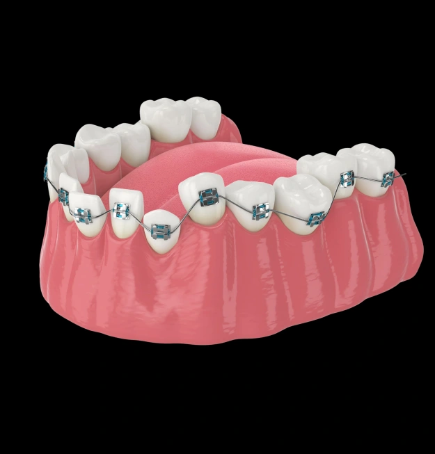Orthodontic Info